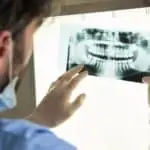 man examines dental x-ray